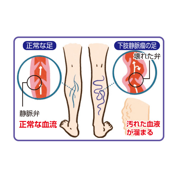 メディカルレッグ